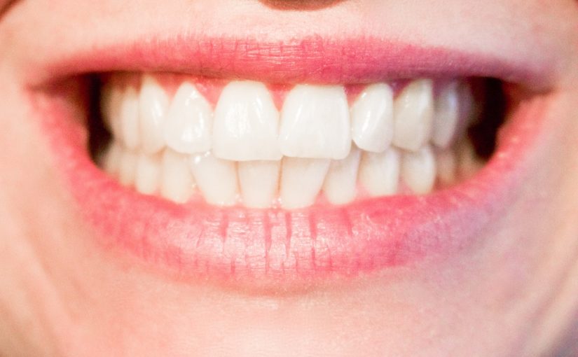 Aktualna technologia stosowana w salonach stomatologii estetycznej być może spowodować, że odzyskamy śliczny uśmiech.